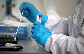 Sobre a suspensão de exigência de apresentação de resultado negativo do teste PCR para Covid-19 na Rússia